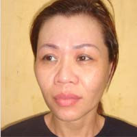 Nguyễn Thị Thu Hiền đã giấu 100 viên ma tuý tổng hợp vào chỗ "kín"