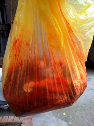 Chỉ cần bỏ ra 200.000 đồng chúng tôi đã có được nhau thai dễ dàng