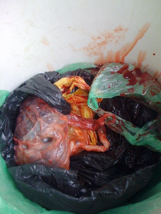 Nhìn hình ảnh này, ai có đủ can đảm để dùng?