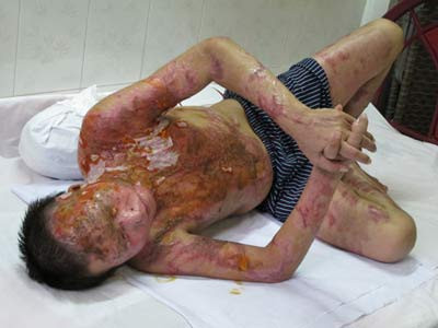 "Tạt axit phải xử tử hình!" ảnh 3 "Tạt axit phải xử tử hình!", An ninh - Hình sự, tat axit, vu an, tat, axit, noi dau axit, canh giac, bao