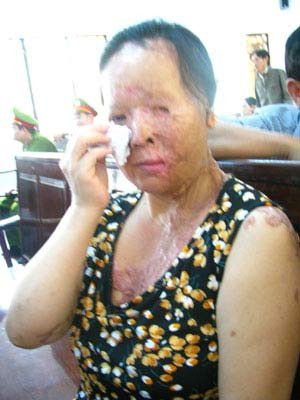 "Tạt axit phải xử tử hình!" ảnh 4 "Tạt axit phải xử tử hình!", An ninh - Hình sự, tat axit, vu an, tat, axit, noi dau axit, canh giac, bao