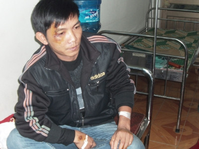 Kiểm lâm Đào Công Thắng nói ông có mặt trên xe gỗ lậu là để ’Truyền đạt thông tin, xin xỏ cho lãnh đạo’ của ông Kiểm lâm Đào Công Thắng nói ông có mặt trên xe gỗ lậu là để ’Truyền đạt thông tin, xin xỏ cho lãnh đạo’ của ông