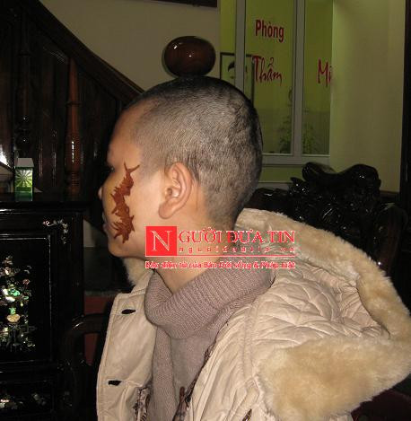 Cô gái 17 tuổi bị tra tấn, cạo trọc, xăm quái vật vào mặt ảnh 1