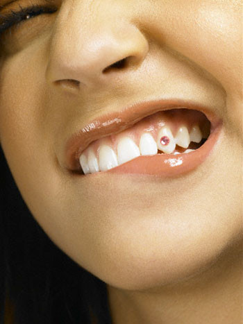 Ảnh minh họa Ảnh minh họa