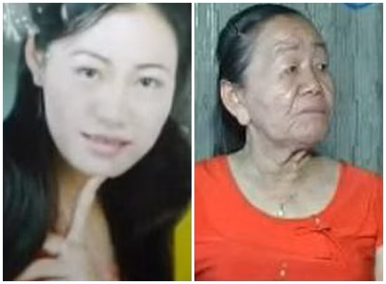 Chị Nguyễn Thị Phượng khi chưa mắc bệnh (trái) và sau khi mắc bệnh (phải).