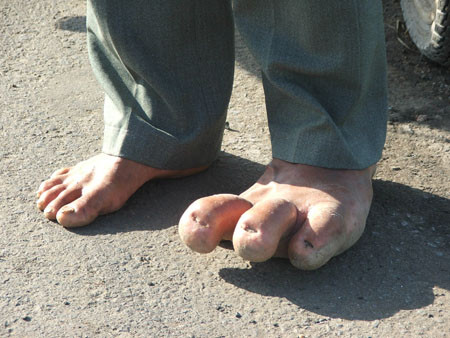 Tuy đi lại khó khăn nhưng anh Tài vẫn điều khiển xe mô tô bình thường Tuy đi lại khó khăn nhưng anh Tài vẫn điều khiển xe mô tô bình thường