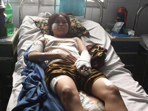 Chị Mai bị chồng cũ đâm khắp người với hơn 10 nhát dao Chị Mai bị chồng cũ đâm khắp người với hơn 10 nhát dao