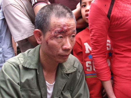 Bộ CA yêu cầu làm rõ vụ CA vụt dùi cui ảnh 2 Bộ CA yêu cầu làm rõ vụ CA vụt dùi cui, Tin tức trong ngày, vut dui cui vao dan, danh nguoi, cong an danh nguoi, vi pham giao thong, vut dui cui, cong an danh dan, cong an, khong doi mu bao hiem, bao, tin tuc, tin hot, tin hay