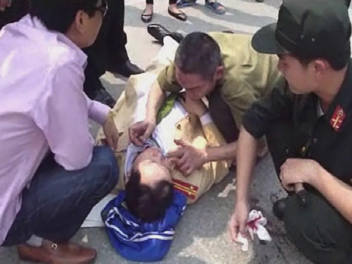 Khởi tố nhân viên Bộ Ngoại giao đâm CSGT ảnh 2 Khởi tố nhân viên Bộ Ngoại giao đâm CSGT, Tin tức trong ngày, dam canh sat, chong nguoi thi hanh cong vu, vi pham giao thong, canh sat 141, nhan vien bo ngoai giao, tan cong canh sat, bao, tin tuc, tin hot, tin hay