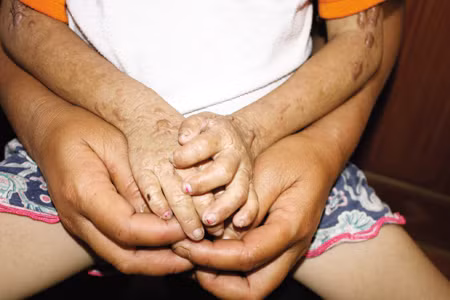 Gia đình “ma cà rồng” đầu tiên ở VN: Cuộc sống trong bóng tối ảnh 1