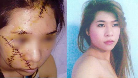 5 người rạch mặt dã man 1 nữ tiếp viên ảnh 1 Xử vụ 5 người rạch mặt dã man 1 nữ tiếp viên, An ninh - Hình sự, rach mat, vu an, dao lam, vu an, an mang, trong an, bao, bao cong an, bao an ninh