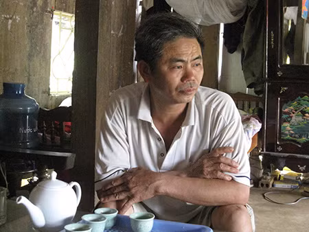 Bi kịch người đàn ông tự luộc bàn tay ảnh 2