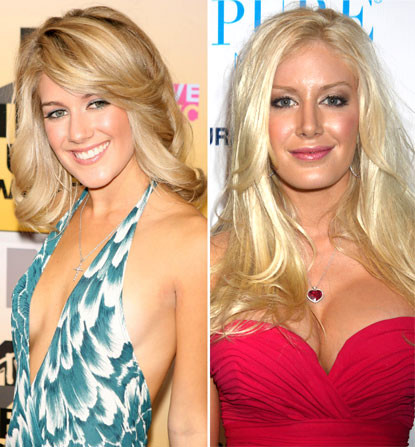 Nữ diễn viên Heidi Montag xinh đẹp và tươi trẻ năm 2006 khi đóng "The Hills" (ảnh trái). Nhưng sau vô số lần phẫu thuật thẩm mỹ, khuôn mặt và thân hình cô hoàn toàn thay đổi, trông như bức tượng sáp nặng nề. Nữ diễn viên Heidi Montag xinh đẹp và tươi trẻ năm 2006 khi đóng "The Hills" (ảnh trái). Nhưng sau vô số lần phẫu thuật thẩm mỹ, khuôn mặt và thân hình cô hoàn toàn thay đổi, trông như bức tượng sáp nặng nề.