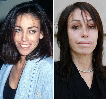 Heidi Fleiss, ngôi sao truyền hình thực tế của Mỹ, ngày càng tàn tạ sau nhiều lần tu bổ nhan sắc. Heidi Fleiss, ngôi sao truyền hình thực tế của Mỹ, ngày càng tàn tạ sau nhiều lần tu bổ nhan sắc.