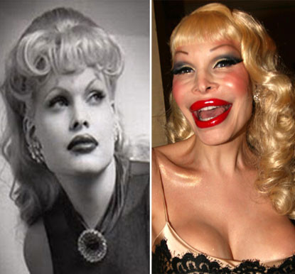 Amanda Lepore sinh ra là con trai nhưng từ bé đã chuyển đổi giới tính thành con gái. Thời kỳ đầu của sự nghiệp người mẫu, cô rất xinh đẹp, nữ tính. Nhưng cô đã trở thành thảm họa phẫu thuật thẩm mỹ với khuôn mặt biến dạng vào năm 2007.. Amanda Lepore sinh ra là con trai nhưng từ bé đã chuyển đổi giới tính thành con gái. Thời kỳ đầu của sự nghiệp người mẫu, cô rất xinh đẹp, nữ tính. Nhưng cô đã trở thành thảm họa phẫu thuật thẩm mỹ với khuôn mặt biến dạng vào năm 2007..
