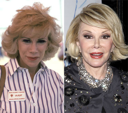 Nữ diễn viên Joan Rivers từng gây sốc khi tiết lộ rằng, cô đã trải qua 739 lần phẫu thuật. Khuôn mặt bà hoàn toàn thay đổi so với hình ảnh năm 1982. Nữ diễn viên Joan Rivers từng gây sốc khi tiết lộ rằng, cô đã trải qua 739 lần phẫu thuật. Khuôn mặt bà hoàn toàn thay đổi so với hình ảnh năm 1982.