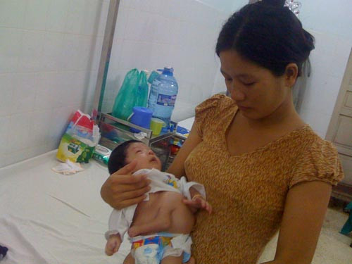 Sẽ phẫu thuật cho bé trai có 4 tay ảnh 1 Sẽ phẫu thuật cho bé trai có 4 tay ảnh 1