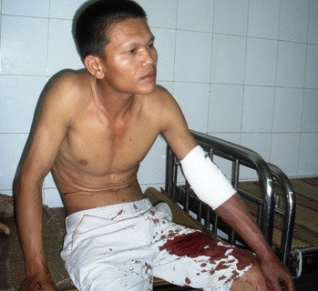 Anh Đinh Văn Luyện tại bệnh viện