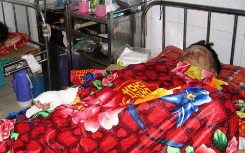 Gã chồng vũ phu cũng nhập viện trong tình trạng nguy kịch Thai phu bi chong thieu song ngay sau tuan trang mat