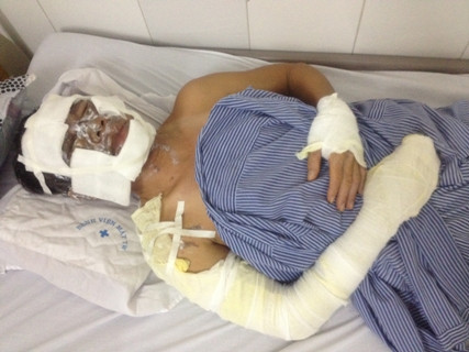 Luật sư Trần Hồng Lĩnh đang được cấp cứu tại Bệnh viện Mắt Trung ương Luật sư Trần Hồng Lĩnh đang được cấp cứu tại Bệnh viện Mắt Trung ương