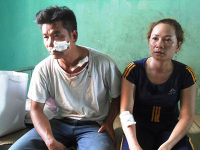 Đang ăn cơm tối, cả gia đình bị côn đồ rượt chém kinh hoàng ảnh 1 Đang ăn cơm tối, cả gia đình bị côn đồ rượt chém kinh hoàng ảnh 1