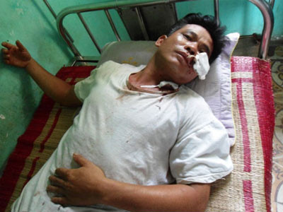 Đang ăn cơm tối, cả gia đình bị côn đồ rượt chém kinh hoàng ảnh 2 Đang ăn cơm tối, cả gia đình bị côn đồ rượt chém kinh hoàng ảnh 2