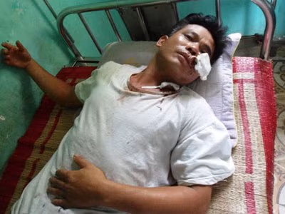 Đang ăn cơm tối, cả gia đình bị côn đồ rượt chém kinh hoàng ảnh 2