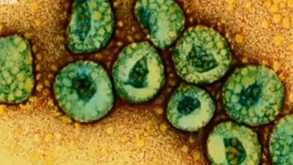 Virus MERS-CoV