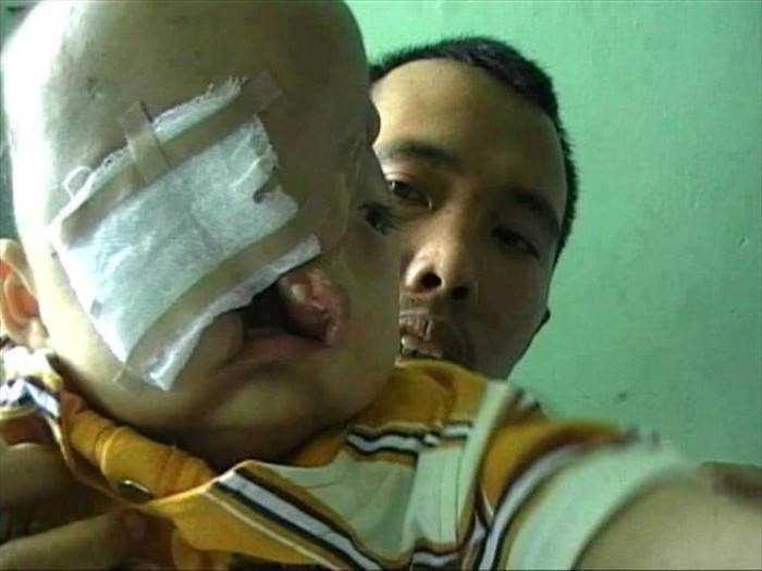 "1 Likes = 1 lời cầu nguyện. 1 share = 100 lời cầu nguyện cho bé. Chúc cho những tổn thất của bé mau chóng qua đi ...", bức ảnh được đăng tải ngày 11/11, nhanh chóng nhận tới 65 303 lượt like (thích), 2 245 lượt chia sẻ, 3 415 bình luận. "1 Likes = 1 lời cầu nguyện. 1 share = 100 lời cầu nguyện cho bé. Chúc cho những tổn thất của bé mau chóng qua đi ...", bức ảnh được đăng tải ngày 11/11, nhanh chóng nhận tới 65 303 lượt like (thích), 2 245 lượt chia sẻ, 3 415 bình luận.