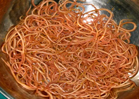 Hơn nửa kg giun sán được các bác sĩ Bệnh viện Đa khoa Quảng Nam vừa phẫu thuật gắp ra từ trong bụng bé Trần Văn Đạt. Ảnh: N.K