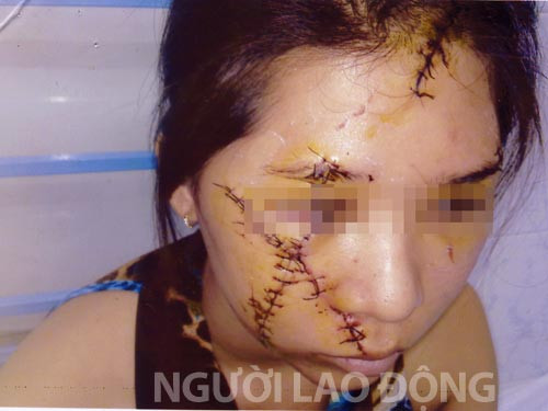 Cầm đầu vụ rạch nát mặt thiếu nữ là một phụ nữ ảnh 1 Cầm đầu vụ rạch nát mặt thiếu nữ là một phụ nữ ảnh 1