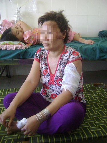 Đổ dầu đốt đầu vợ để xoá... hình ảnh người tình ảnh 1 Đổ dầu đốt đầu vợ để xoá... hình ảnh người tình ảnh 1