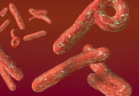 Virus Ebola. Cụ thể, nước Guinea ghi nhận 427 trường hợp tử vong, Liberia 249 trường hợp và Sierra Leone 525 trường hợp. Virus Ebola. Cụ thể, nước Guinea ghi nhận 427 trường hợp tử vong, Liberia 249 trường hợp và Sierra Leone 525 trường hợp.