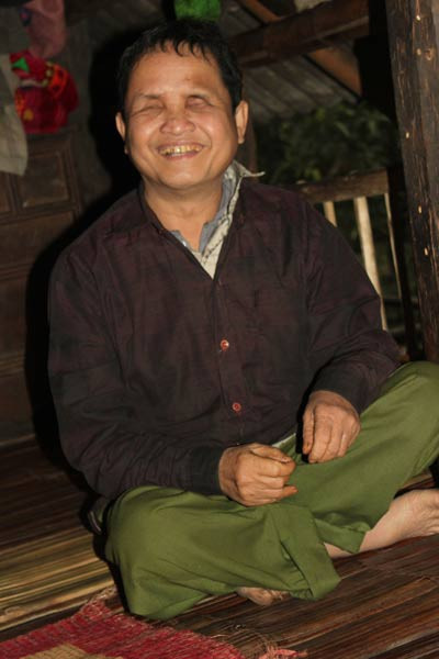 Kỳ diệu người đàn ông có “con mắt thứ 3” ảnh 3 Kỳ diệu người đàn ông có “con mắt thứ 3”, Tin tức trong ngày, nguoi dan ong ba mat, con mat thu 3, kha nang dac biet, ky nhan, la lung, giac quan nhay cam, tin tuc, tin nhanh, tin hot, vn