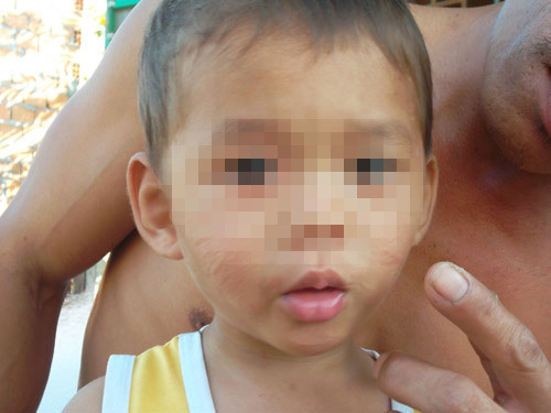 Vụ bé trai bị rạch mặt: Ngứa mắt là rạch, Tin tức trong ngày, be trai bi rach mat, rach mat be trai, rach mat, tam than, ngua mat, quang ngai, hanh dong vo nhan tinh, bao, tin tuc, tin hot, tin hay, vn