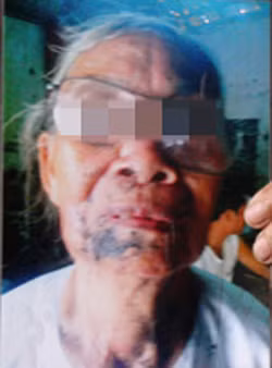 Tấm ảnh bà Nhưng bị con gái và con rể hành hung sau khi công an xã đến làm việc. Tấm ảnh bà Nhưng bị con gái và con rể hành hung sau khi công an xã đến làm việc.