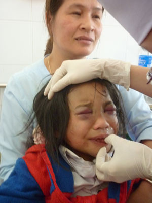 Bắt đối tượng hành hạ con nuôi 10 tuổi ảnh 1