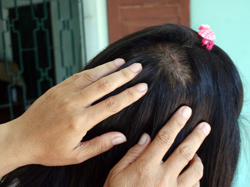 Bị bạo hành, 5 mẹ con kêu cứu ảnh 1