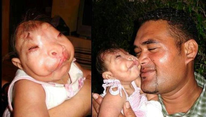 "Một bức ảnh cảm động về tình cha con".