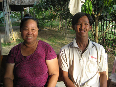 Suốt 29 năm qua, anh Hây không mọc một cái răng nào.