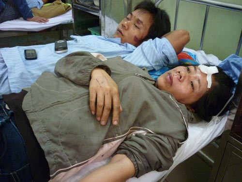 Vụ TNGT ở Bình Thuận: Không cứu kịp vì xe cháy dữ quá! ảnh 2 Vụ TNGT ở Bình Thuận: Không cứu kịp vì xe cháy dữ quá! ảnh 2