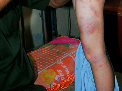 Bé trai 7 tuổi bị cha nuôi đánh đập dã man ảnh 1 Bé trai 7 tuổi bị cha nuôi đánh đập dã man ảnh 1