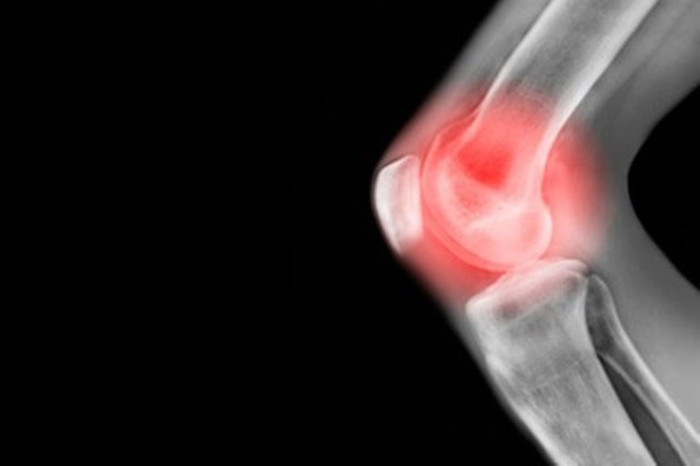 5. Chữa sưng đau cơ khớp: Củ kiệu 20g giã nát hòa với giấm, đảo đều hâm nóng đắp lên chỗ khớp sưng đau. Ngày đắp 2 lần. 5. Chữa sưng đau cơ khớp: Củ kiệu 20g giã nát hòa với giấm, đảo đều hâm nóng đắp lên chỗ khớp sưng đau. Ngày đắp 2 lần.