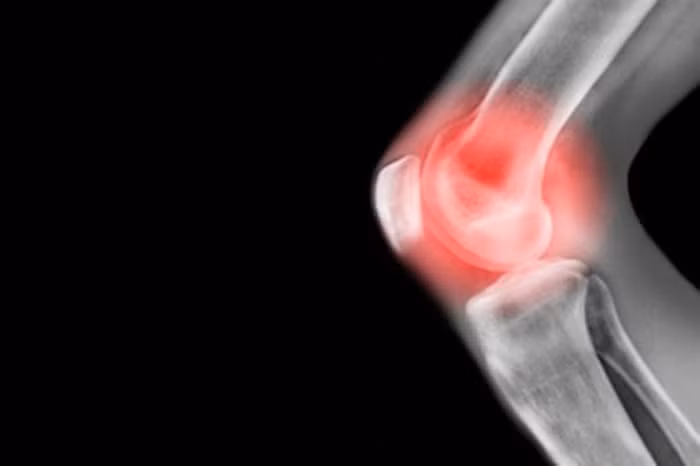 5. Chữa sưng đau cơ khớp: Củ kiệu 20g giã nát hòa với giấm, đảo đều hâm nóng đắp lên chỗ khớp sưng đau. Ngày đắp 2 lần.