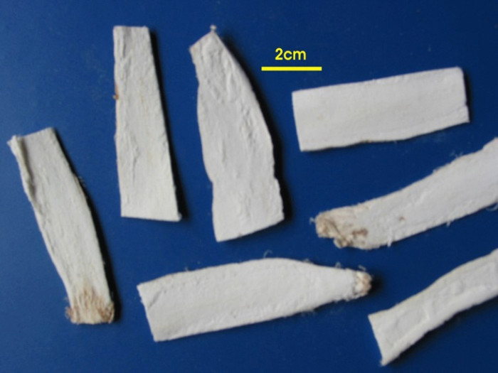 Bài 4: Trường hợp trẻ sốt nhiều, nôn mửa, khát nước, buồn bực, dùng bài Khoan trung thấu độc ẩm: Cát căn 12g, tiền hồ 12g, cát cánh 12g, thanh bì 8g, chỉ xác 6g, thuyền thoái 8g, kinh giới 8g, sơn tra 8g, liên kiều 8g, mạch nha 8g. Sắc uống ngày một thang. Bài 4: Trường hợp trẻ sốt nhiều, nôn mửa, khát nước, buồn bực, dùng bài Khoan trung thấu độc ẩm: Cát căn 12g, tiền hồ 12g, cát cánh 12g, thanh bì 8g, chỉ xác 6g, thuyền thoái 8g, kinh giới 8g, sơn tra 8g, liên kiều 8g, mạch nha 8g. Sắc uống ngày một thang.
