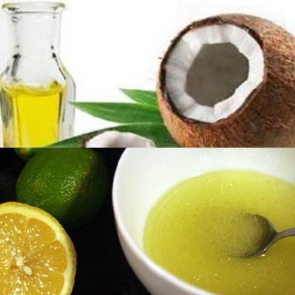 9. Cách một ngày thoa một lần hỗn hợp gồm một muỗng nhỏ dầu dừa với nửa muỗng to nước ép chanh tươi vào chân tóc rồi xoa bóp nhẹ da đầu. 9. Cách một ngày thoa một lần hỗn hợp gồm một muỗng nhỏ dầu dừa với nửa muỗng to nước ép chanh tươi vào chân tóc rồi xoa bóp nhẹ da đầu.