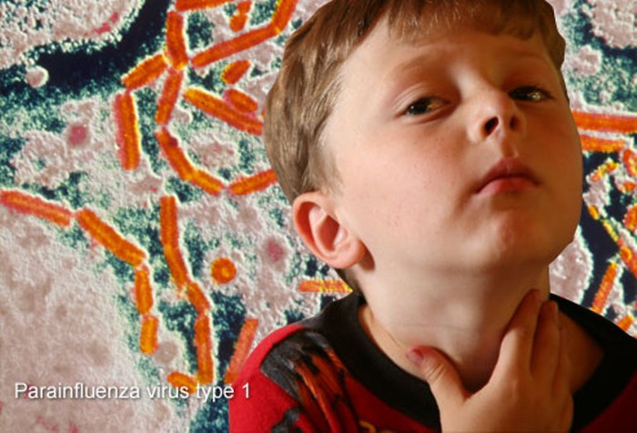 4. Viêm thanh quản: Nguyên nhân là do viêm đường hô hấp trên, thường là do virus gây ra. Bệnh ảnh hưởng trực tiếp đến đường thở, khi phát hiện bệnh cần phải đưa vào bệnh viện để có những điều trị kịp thời. Bệnh phổ biến nhất ở trẻ em dưới 5 tuổi. 4. Viêm thanh quản: Nguyên nhân là do viêm đường hô hấp trên, thường là do virus gây ra. Bệnh ảnh hưởng trực tiếp đến đường thở, khi phát hiện bệnh cần phải đưa vào bệnh viện để có những điều trị kịp thời. Bệnh phổ biến nhất ở trẻ em dưới 5 tuổi.