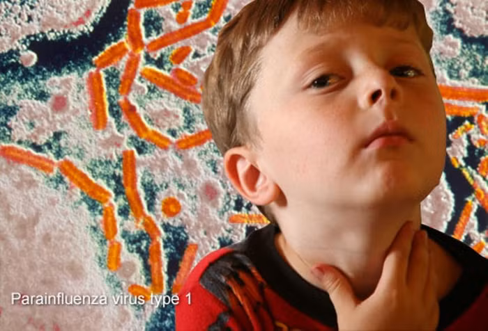 4. Viêm thanh quản: Nguyên nhân là do viêm đường hô hấp trên, thường là do virus gây ra. Bệnh ảnh hưởng trực tiếp đến đường thở, khi phát hiện bệnh cần phải đưa vào bệnh viện để có những điều trị kịp thời. Bệnh phổ biến nhất ở trẻ em dưới 5 tuổi.