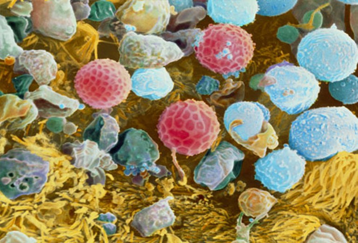 24. Dị ứng theo mùa: Các triệu chứng bao gồm hắt hơi, chảy nước mắt, chảy nước mũi hoặc nghẹt mũi và có thể chỉ xảy ra vào mùa xuân hoặc mùa thu. Đối với lọai dị ứng này thì có thể dùng thuốc hoặc phương pháp dân gian. 24. Dị ứng theo mùa: Các triệu chứng bao gồm hắt hơi, chảy nước mắt, chảy nước mũi hoặc nghẹt mũi và có thể chỉ xảy ra vào mùa xuân hoặc mùa thu. Đối với lọai dị ứng này thì có thể dùng thuốc hoặc phương pháp dân gian.