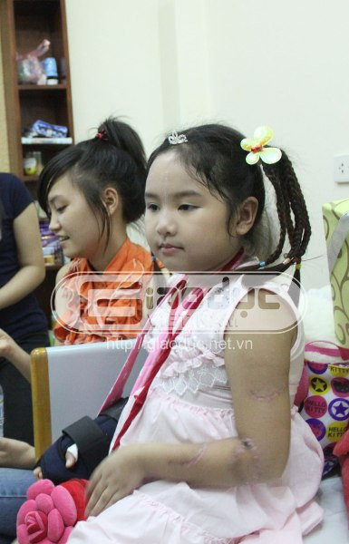 Các vết thương trên cơ thể cháu Bích đã lành trở lại, nhưng còn đó những dấu vết của vụ thảm sát kinh hoàng.